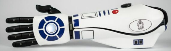 Open Bionics : Un bras bionique aux couleurs de R2D2
